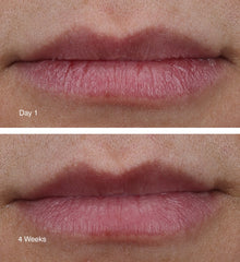 Before and after comparison of lips with 'Day 1' and '4 Weeks' labels after applying peptide lip treatment.